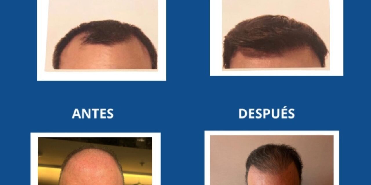 Krauter: la verdadera clave para un cabello saludable