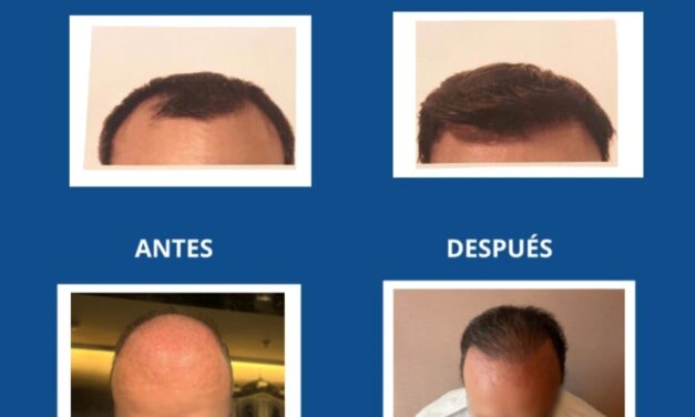 Krauter: la verdadera clave para un cabello saludable