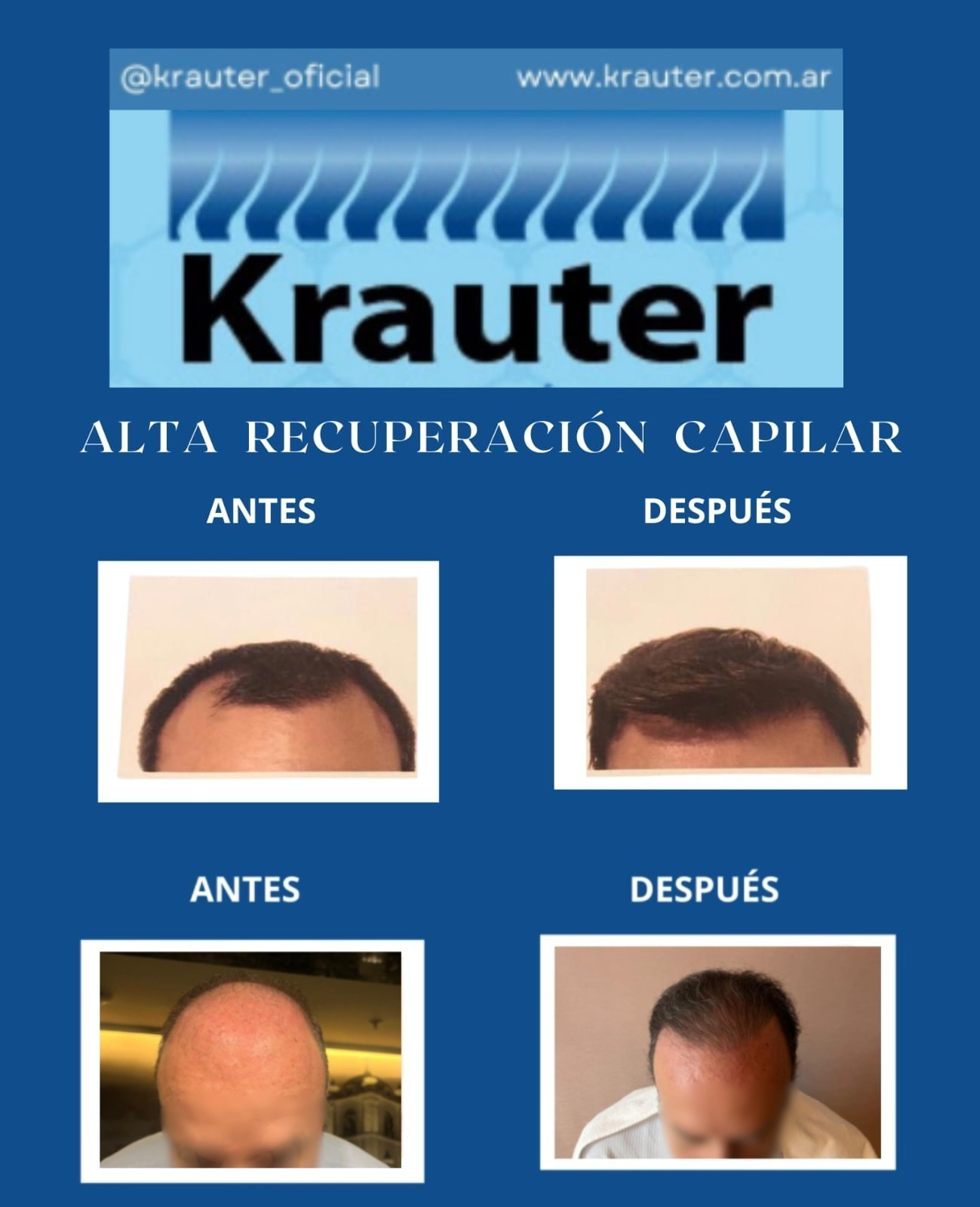 Krauter