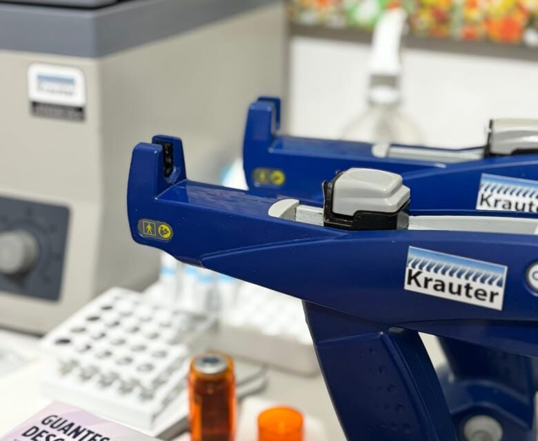 Mi Pelo Necesita Ayuda? Descubrí si deberías hacer una Consulta con Krauter