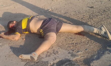 Todo al revés: Quiso robar a mano armada en el Acceso, lo atropellaron, y la Justicia imputa a una víctima