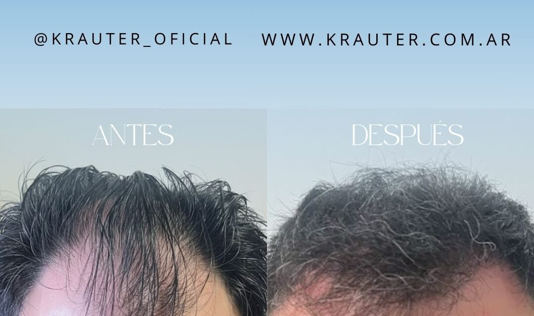 El "reseteo" profesional que tu pelo necesita post-verano está en Krauter
