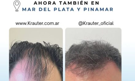 ¿Notás más caída tras un período de mucho estrés? El impacto de las tensiones en tu salud capilar