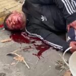 Robaba cables en Quilmes Centro, se electrocutó, cayó de altura, y VIVE!!!