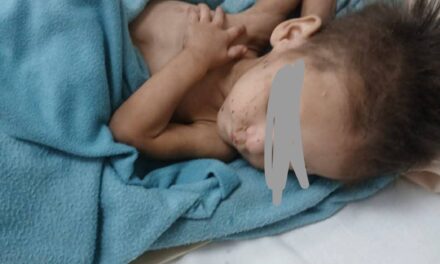 Varela: Siete hermanos fueron encontrados solos y en grave estado de abandono