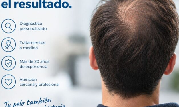 ¿Caída del cabello a los 20 años? Por qué actuar a tiempo cambia por completo el resultado